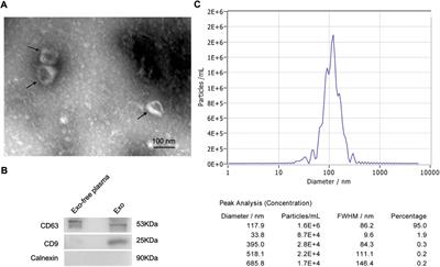 Exosomal microRNA panel as a diagnostic biomarker in patients with hepatocellular carcinoma